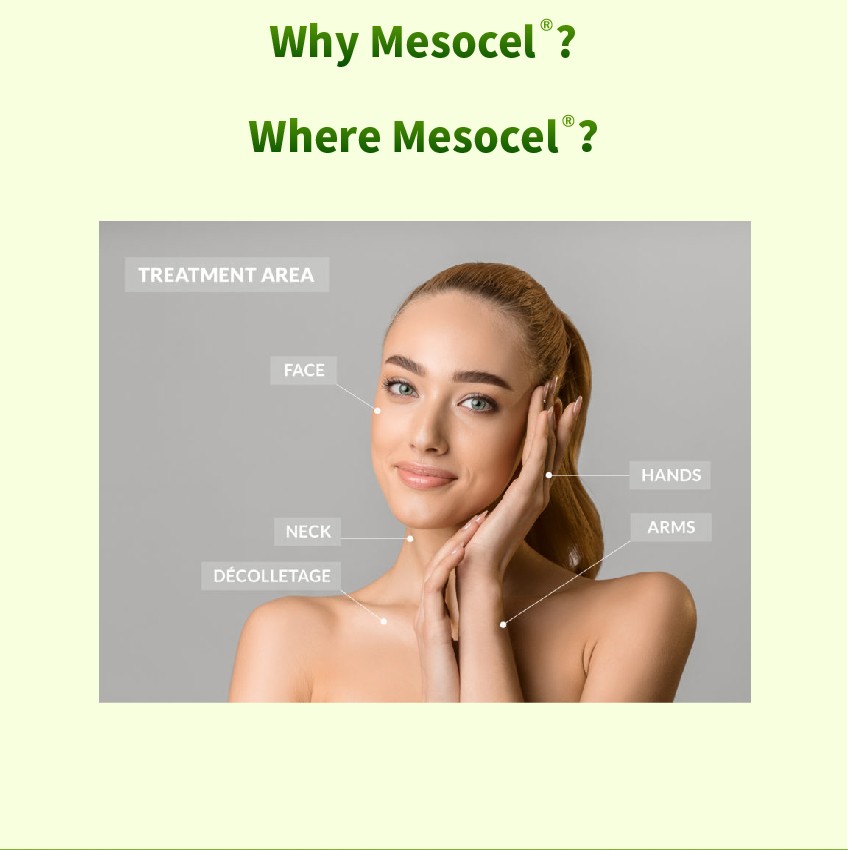 mesotherapy injections appllication area - Dermax