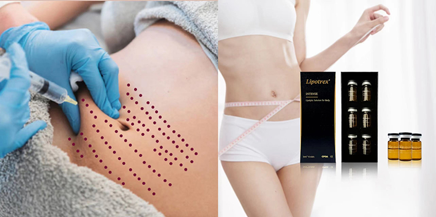 Lipotrex face and body injection tips