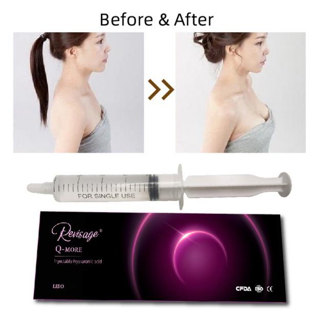 Is HA Gel Injections EFFECT FOR Breast Enhancement (6)