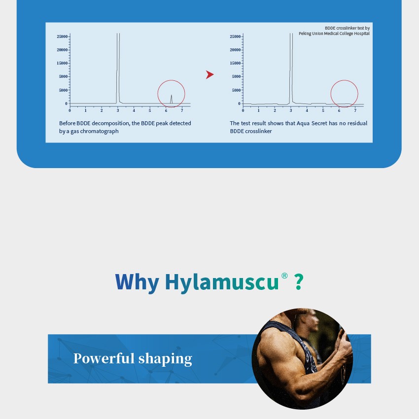 Hylamuscu dermal filler injection (8)