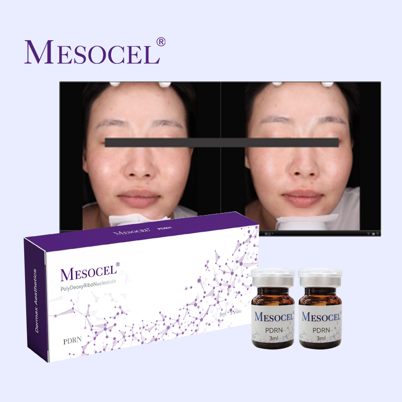 Mesocel® Pdrn Injection Price