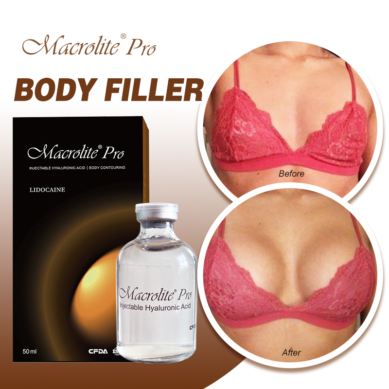 Breast Body Filler Injection