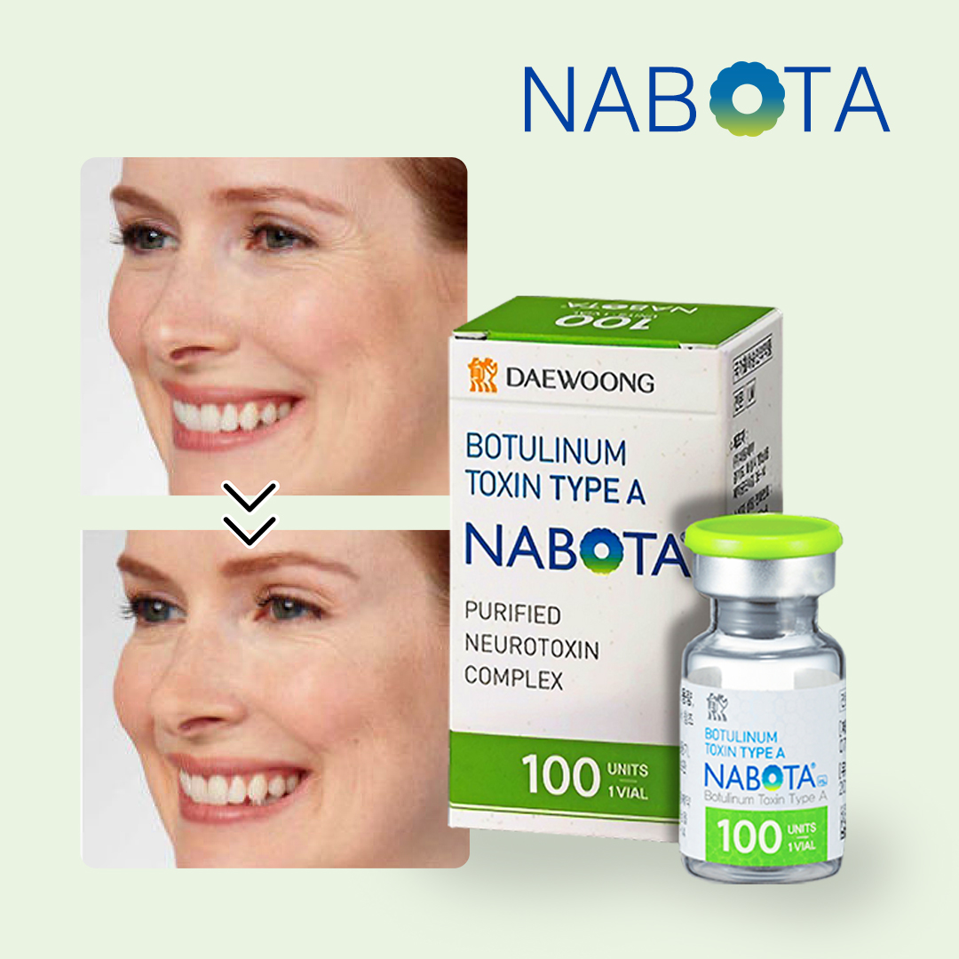 nabota 100 units