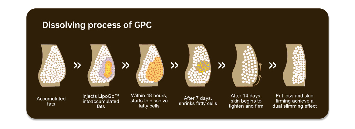 Lipolysis Injections