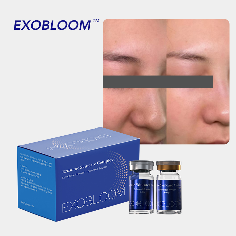 Exobloom Exosomes for Face