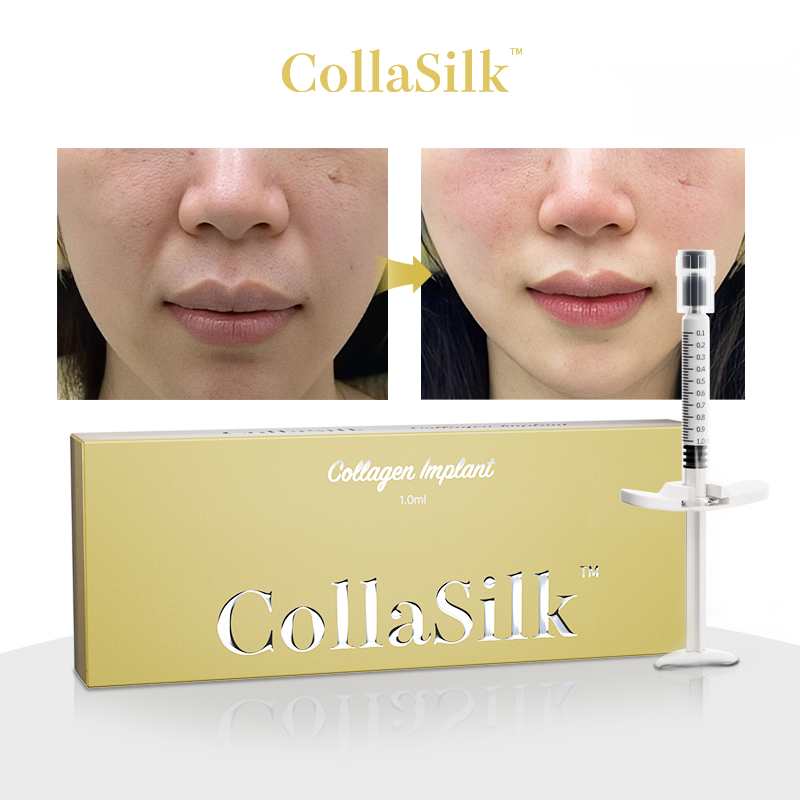 Collasilk Collagen Implant