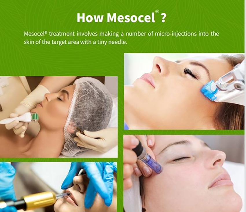 What-are-the-side-effects-of-injecting-Mesocel-and-will-it-form-dependence