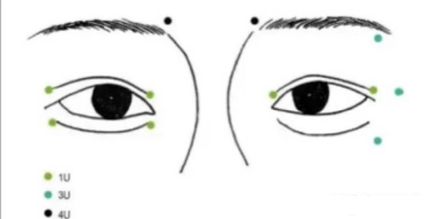 Can Botulax enlarge eye