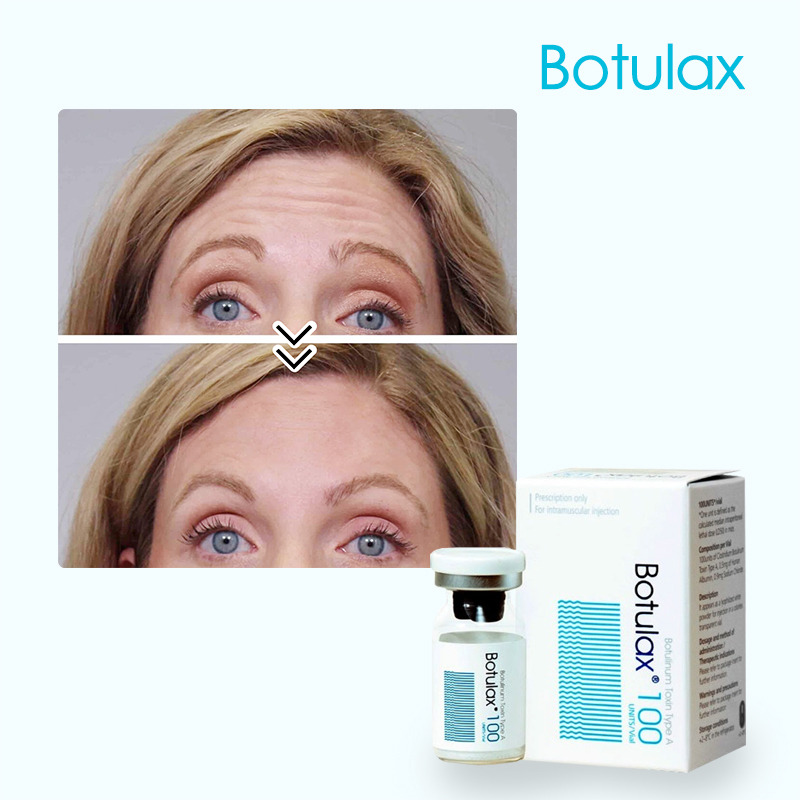 botulax 100 how to use