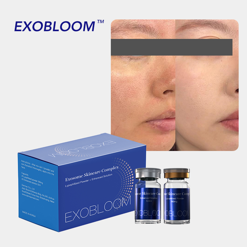 Exobloom Exosomes for Face