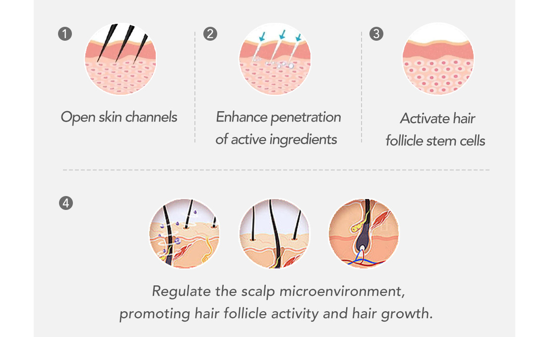 Exosomes for Hair Growth