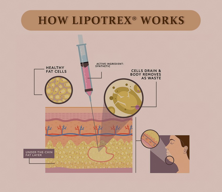 Lioptrx smooth Lipolytic Solution (2)