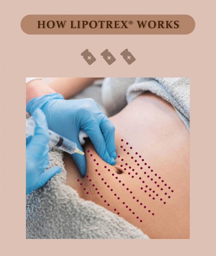lipotropic injections for weight loss treatments - Dermax