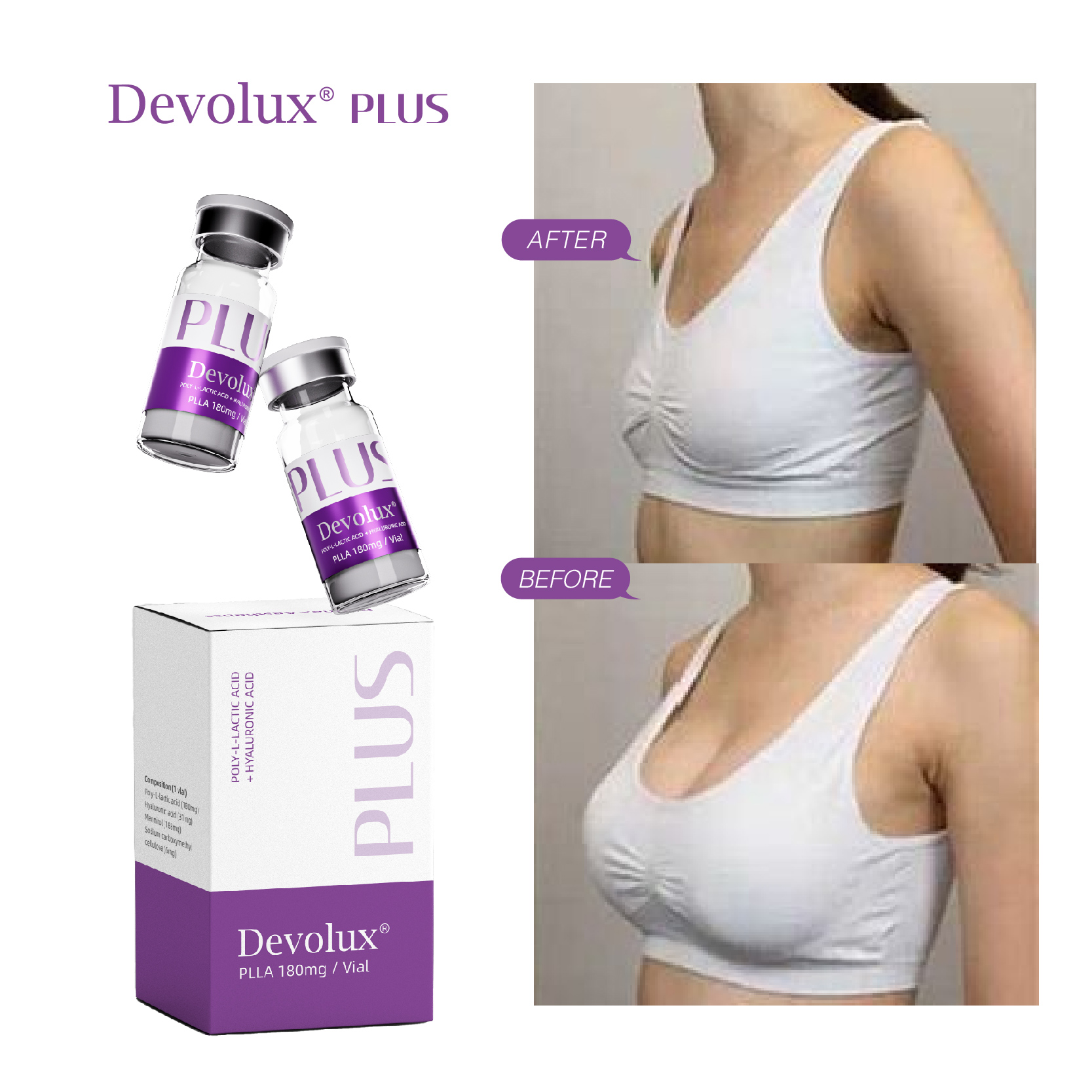 Devolux Plus Plla Filler for Breast