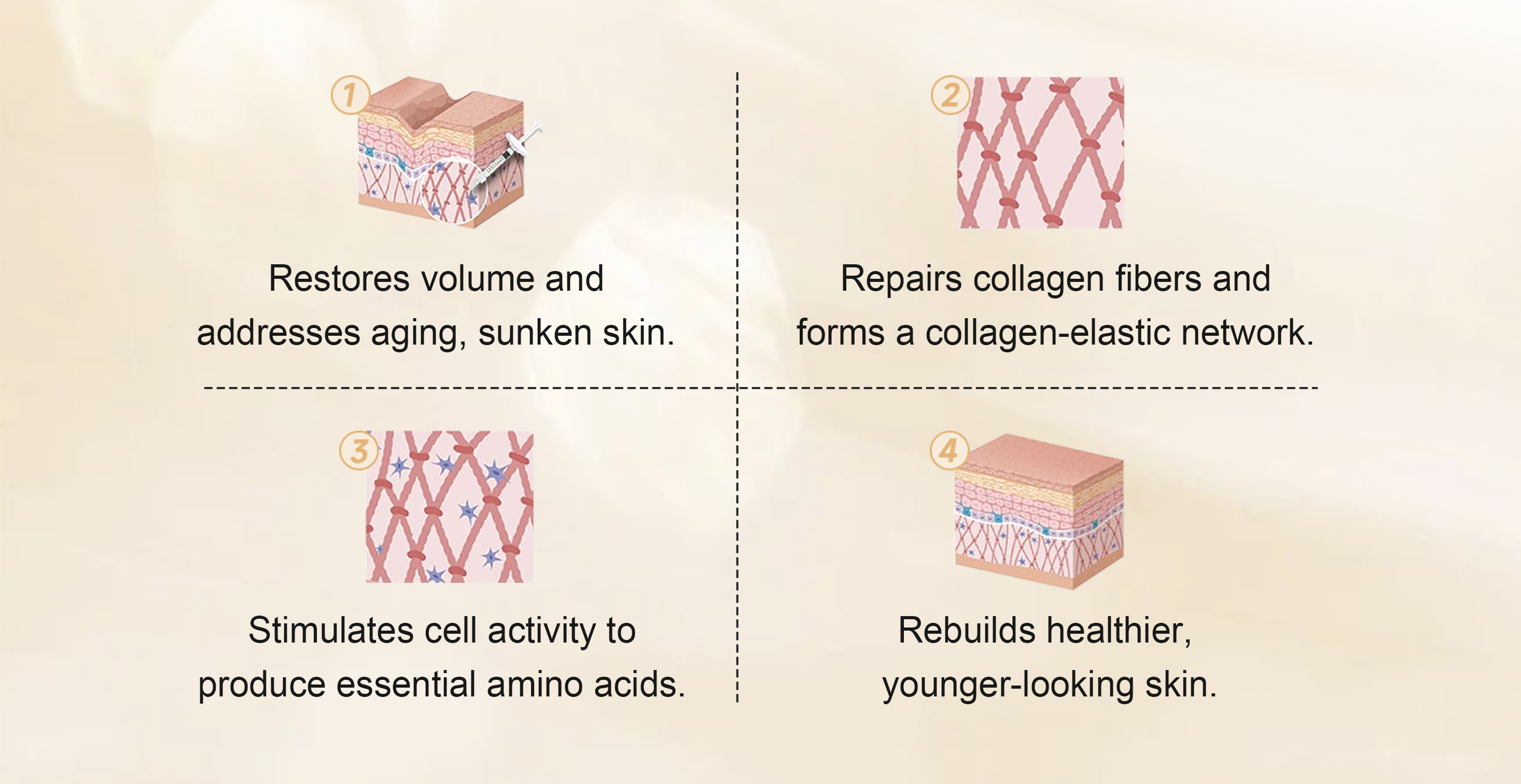 Collagen Implant
