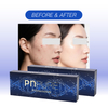 PNPURE Polynucleotides Injections