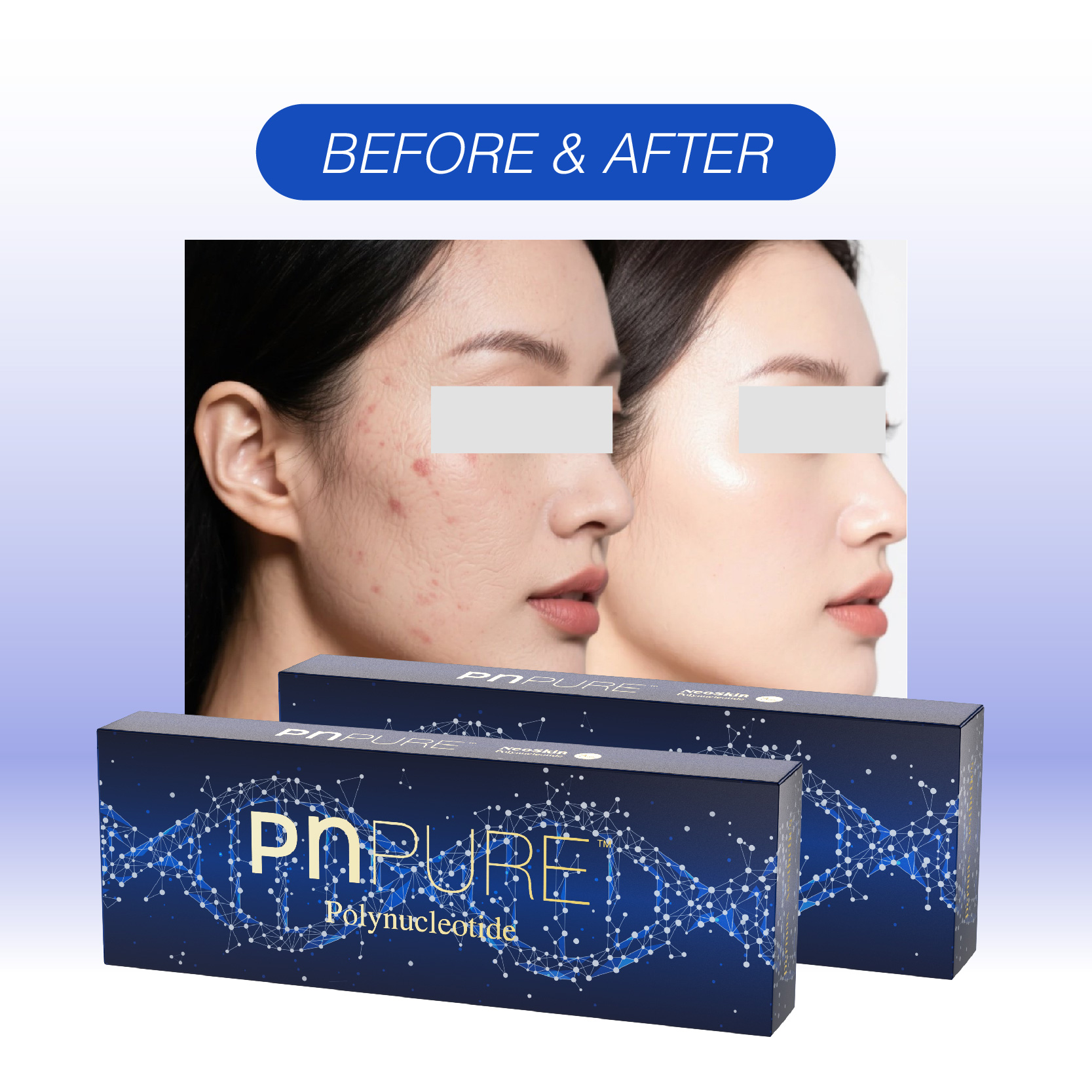 PNPURE Polynucleotides Injections
