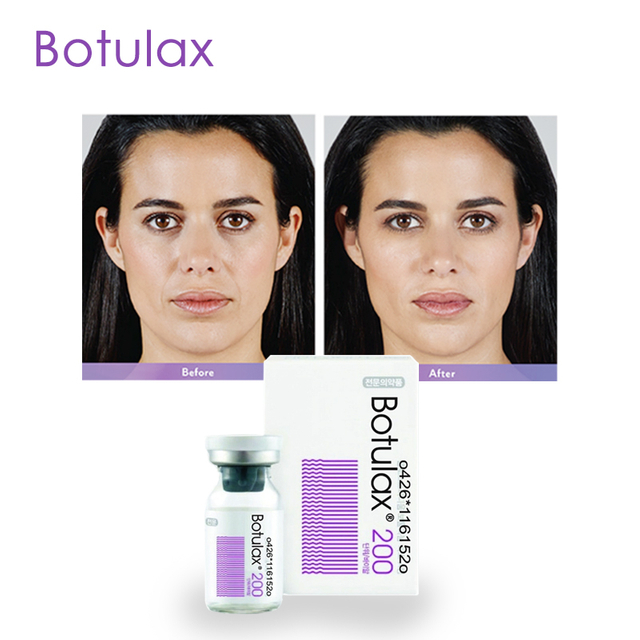 buy Botulinum Toxin online 50 units