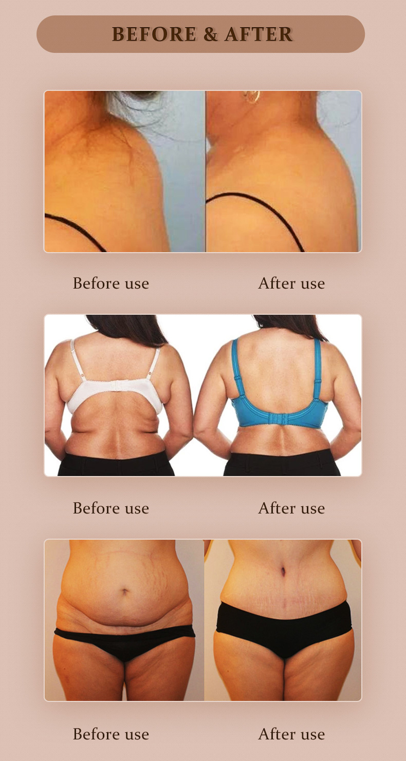 lipotropic injections for weight loss before vs after - dermax