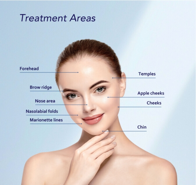 application of CHArmacy Calcium Hydroxyapatite Filler