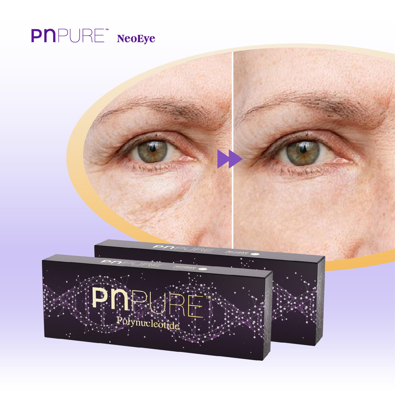 PNPURE Polynucleotides Injections