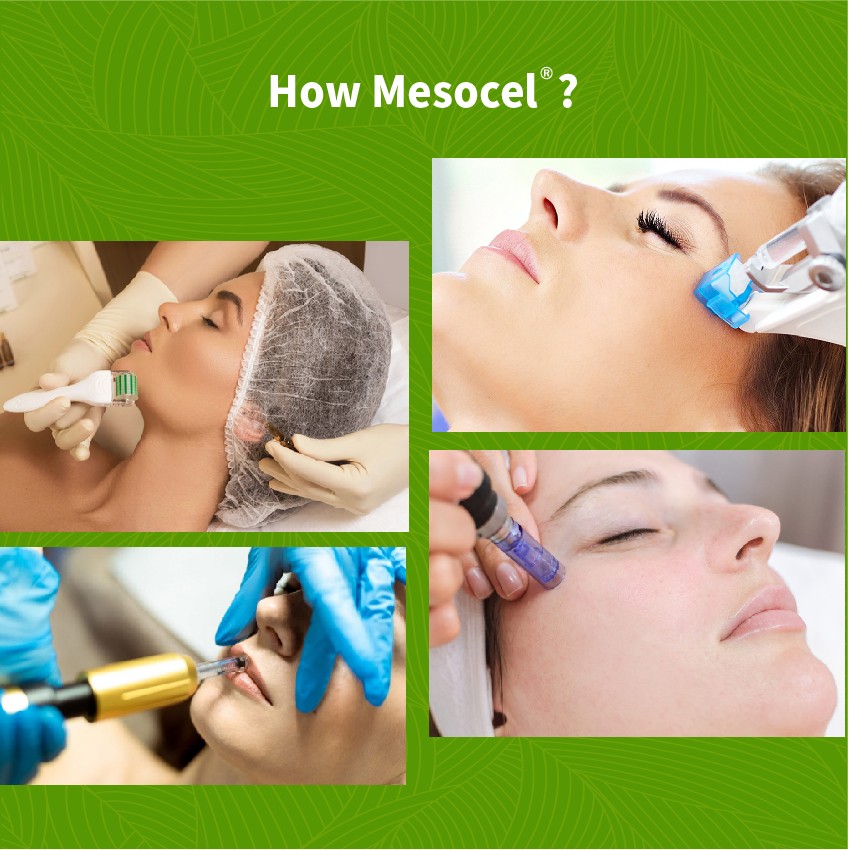 mesotherapy injections using - Dermax