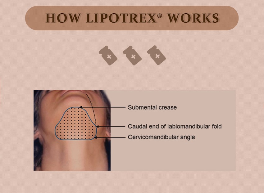 Lioptrx smooth Lipolytic Solution (4)