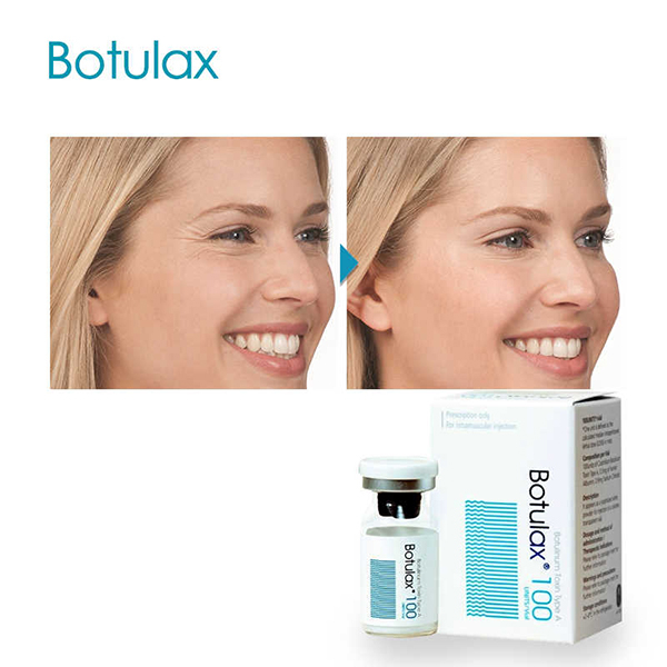 Botulinum Toxin Buy Online