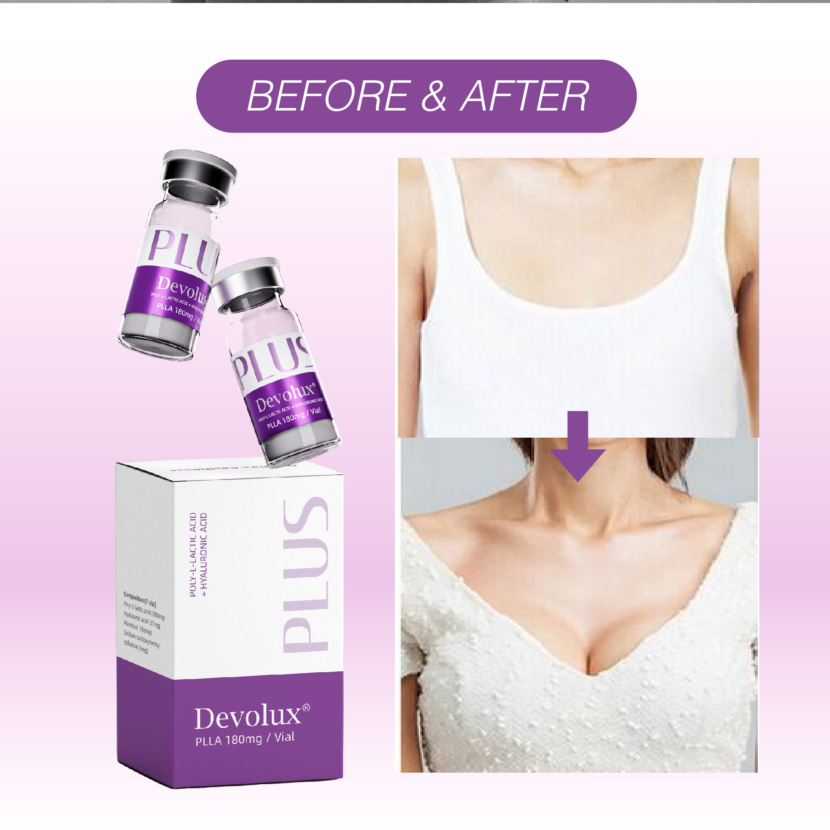 Devolux Plus Plla Filler for Breast
