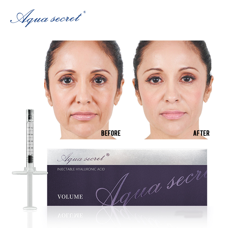 best dermal filler