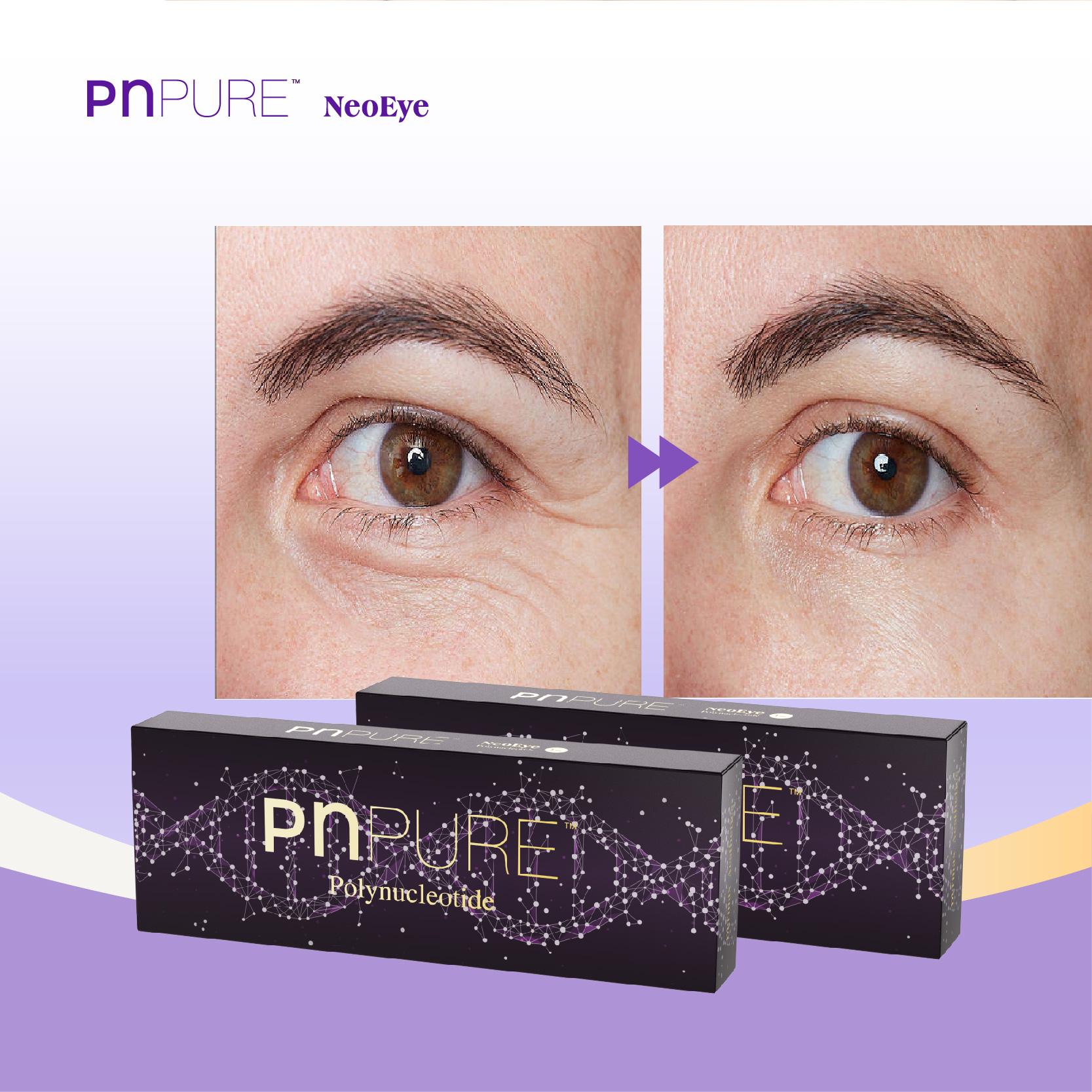 PNPURE Polynucleotides Injections