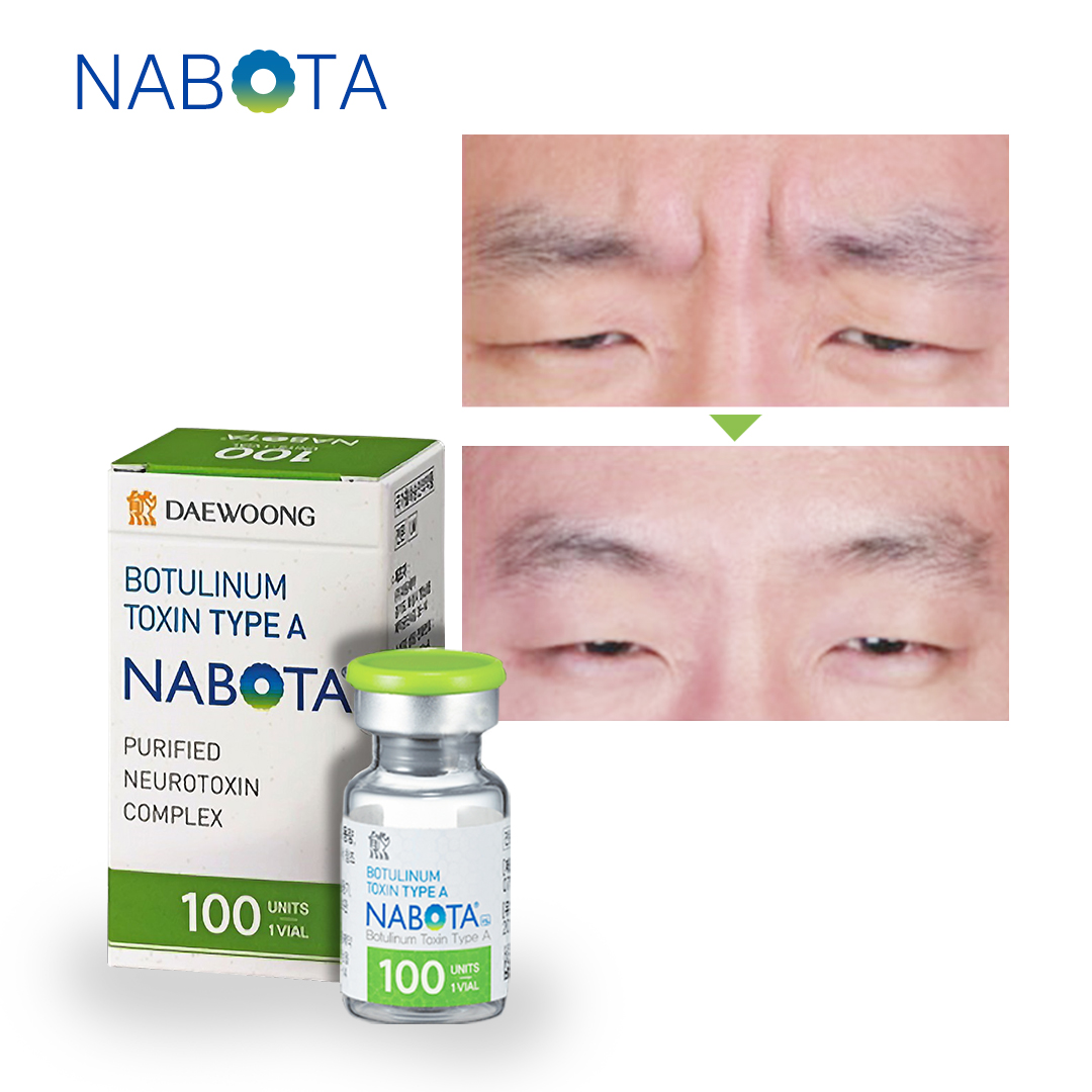 nabota botulinum toxin buy online