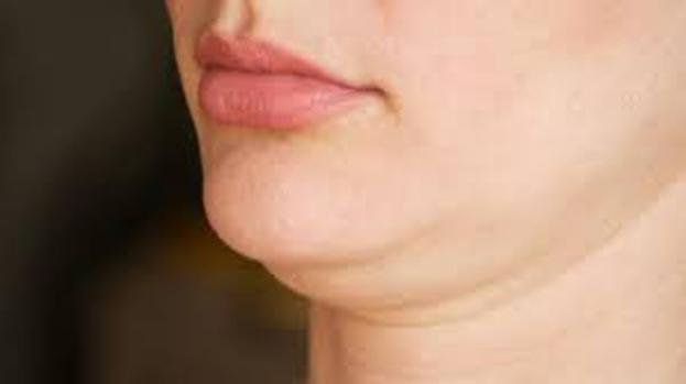 Scientific Perspective On Double Chin (1)