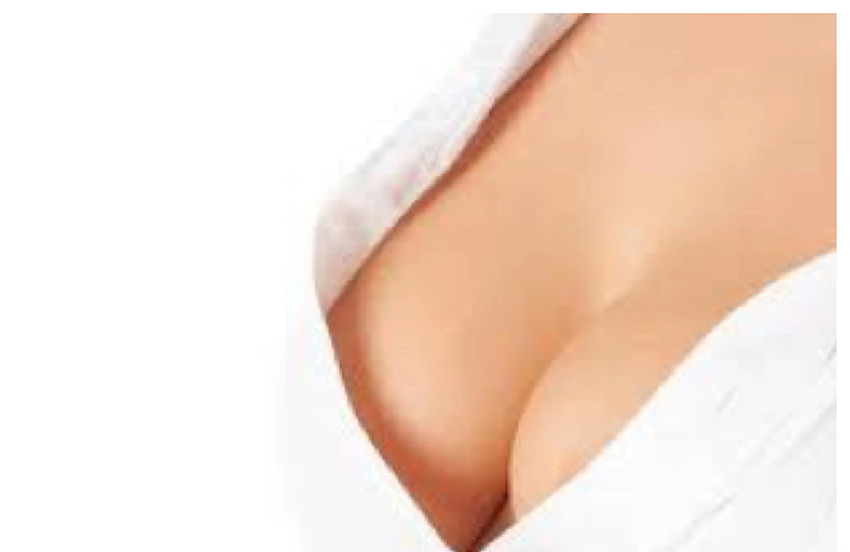 breast enhancement with hyaluronic acid Aqua Secret Macrolite