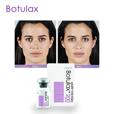 Botulinum Toxin In Aesthetic Medicine