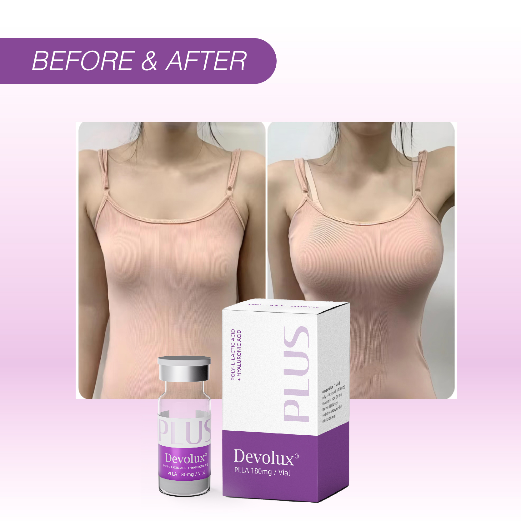 Plla Filler for Breast