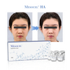 Mesocel® Hyaluronic Acid for Microneedling
